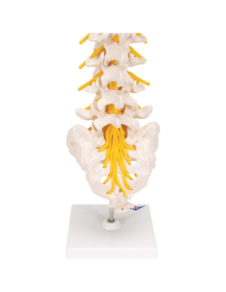 Columna Vertebral Lumbar 3B Scientific A76/5 con Disco Prolapsado 34 cm