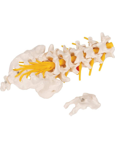 Columna Vertebral Lumbar 3B Scientific A76/5 con Disco Prolapsado 34 cm