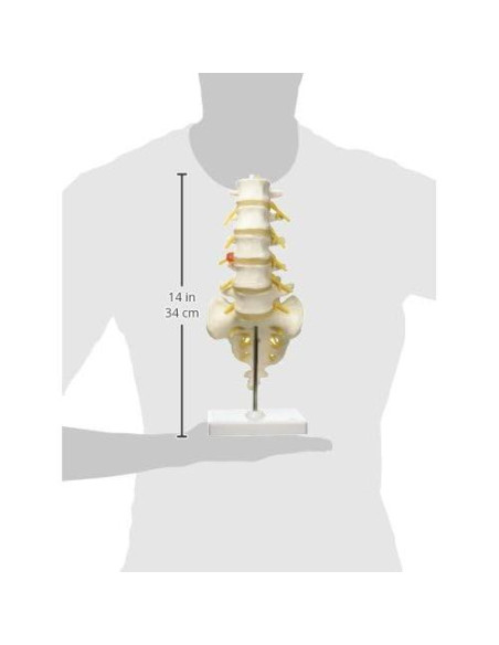 Columna Vertebral Lumbar 3B Scientific A76/5 con Disco Prolapsado 34 cm