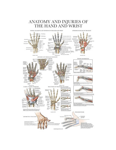 Póster Anatomía y Lesiones Mano y Muñeca Palace Learning 45.72x60.96 cm