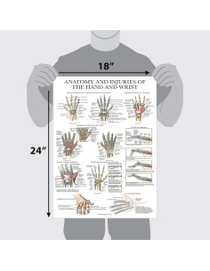 Póster Anatomía y Lesiones Mano y Muñeca Palace Learning 45.72x60.96 cm 2