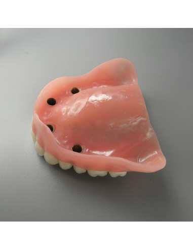 Modelo Dental Sobredentadura Superior Smile1000 4 Implantes