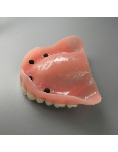Modelo Dental Sobredentadura Superior Smile1000 4 Implantes
