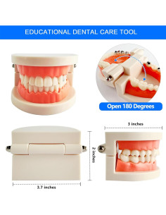 Modelo de Caries Dental 1:1 Ceonam - Dientes No Removibles 2