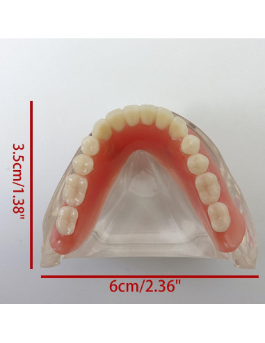 Modelo Dental Sobredentadura Inferior Smile1000 2 Implantes