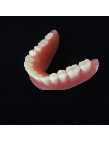 Modelo Dental Sobredentadura Inferior Smile1000 2 Implantes