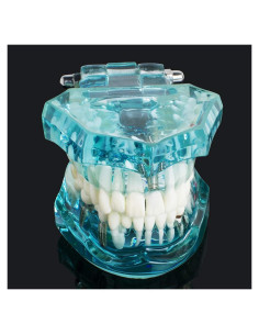 Modelo de Implante Dental Typodont Azul Transparente