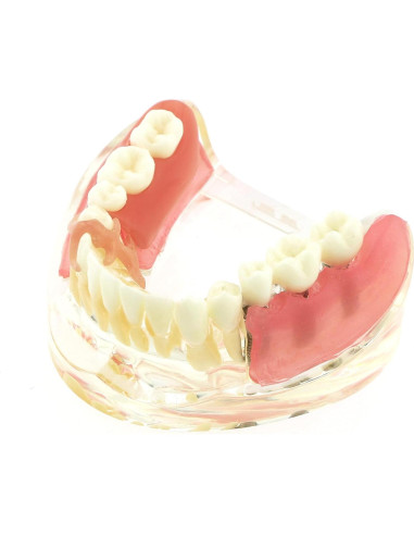 Modelo Dientes de Implante Pinnasilxm M6006 Puente Inferior 3 Implantes