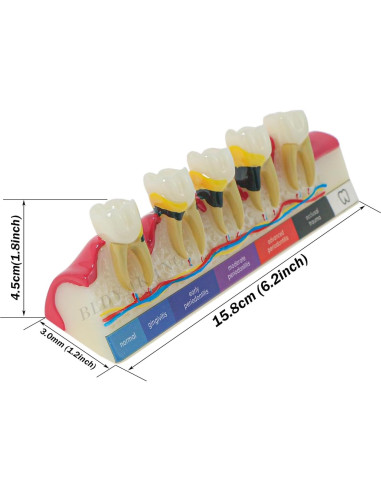 Modelo Dental Periodontal BLDYAKANG para Educación Oral
