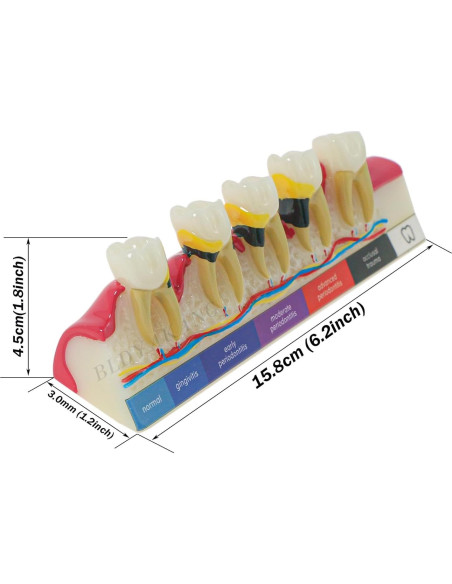 Modelo Dental Periodontal BLDYAKANG para Educación Oral