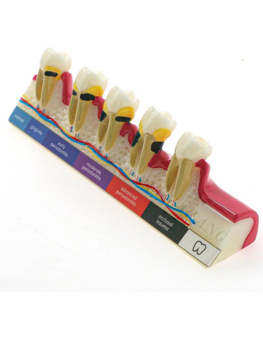 Modelo Dental Periodontal BLDYAKANG para Educación Oral