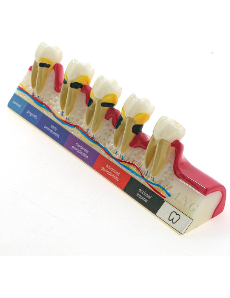 Modelo Dental Periodontal BLDYAKANG para Educación Oral