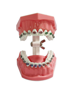 Modelo Dental Ortodóntico Ceonam con Brackets - Typodont Educativo