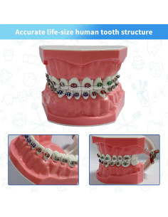 Modelo Dental Ortodóntico Ceonam con Brackets - Typodont Educativo 2