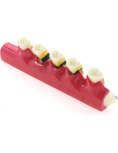 Modelo Dental Periodontal BLDYAKANG para Educación Oral