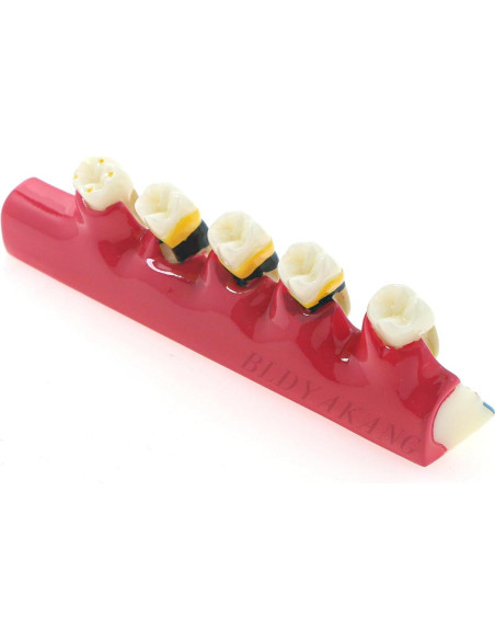 Modelo Dental Periodontal BLDYAKANG para Educación Oral