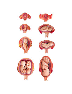 Modelo Anatómico del Feto Wellden Medical 8 Etapas