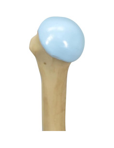 Modelo Anatómico de Hombro Osteoartrítico GPI 4 Etapas 2