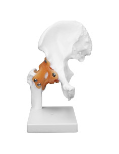 Modelo Anatómico de Cadera Humana con Ligamentos PVC 26cm