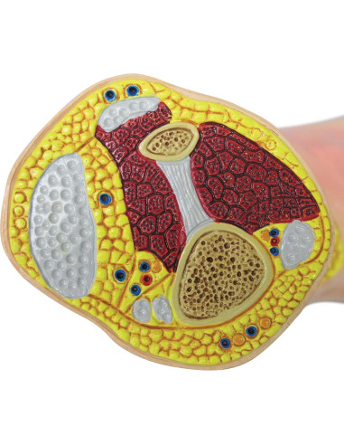 Modelo de Pie Izquierdo con Gota GPI Anatomicals 22.2x10.2cm