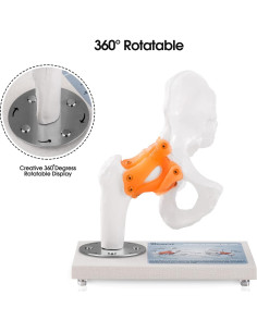 Modelo Anatómico de Articulación de Cadera Ultrassist 1:1 PVC 2