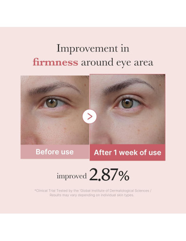 Suero para Ojos Medicube PDRN con Retinol y Niacinamida 30ml