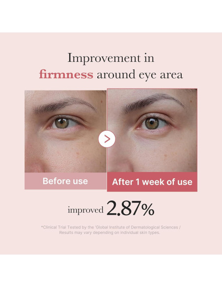 Suero para Ojos Medicube PDRN con Retinol y Niacinamida 30ml