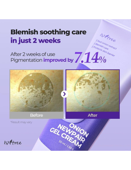 Gel Crema de Cebolla ISNTREE 50ml - Cuidado de Manchas y Blemish Gel Crema de Cebolla ISNTREE 50ml - Cuidado de Manchas y Blemish