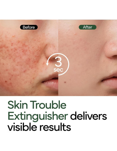 Crema Reparadora Intensiva Cica UCL 50g - Hidratante Piel Sensible