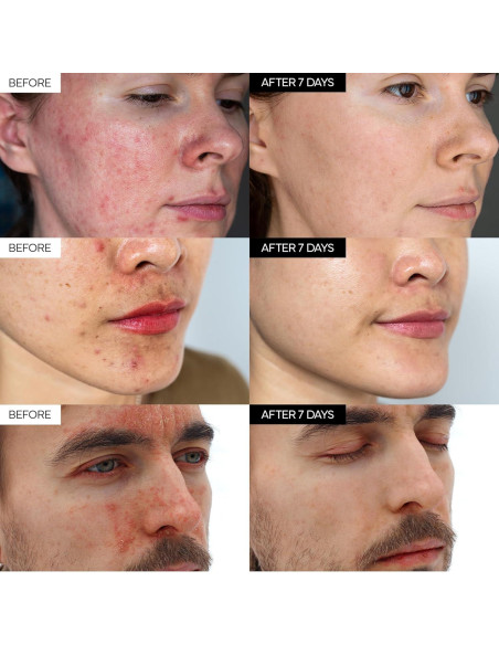 Crema Reparadora Intensiva Cica UCL 50g - Hidratante Piel Sensible