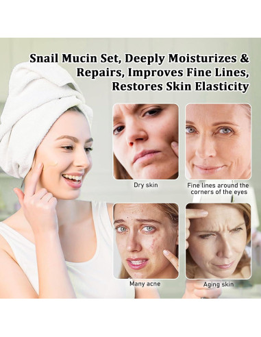 Kit de Cuidado de Piel RodPere con Mucina de Caracol 4 Piezas