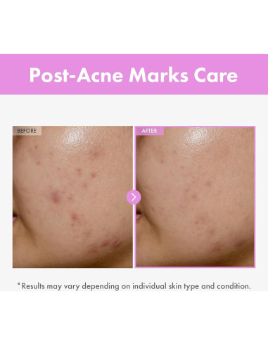 Suero Facial Tosowoong 9 Péptidos 150ml - Cuidado Piel Coreano