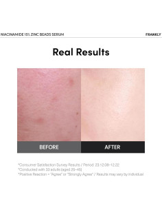 Suero Niacinamida 15% Frankly 59.87 ml - Cuidado Acné y Manchas 2