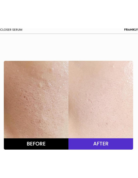 Suero Closer Frankly 30 ml | Minimizador de Poros Vegano