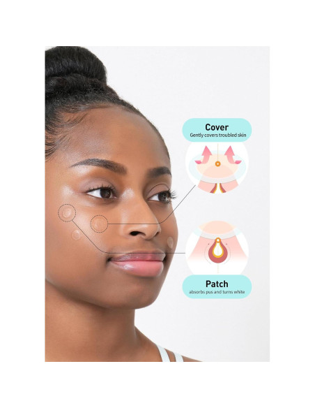 Parche para Acné Hidrocoloide OLIVE YOUNG 306 Unidades Parche para Acné Hidrocoloide OLIVE YOUNG 306 Unidades
