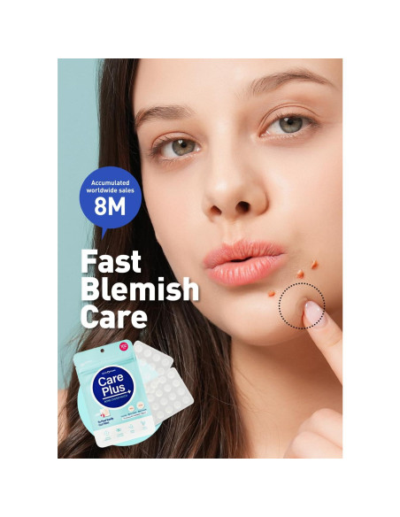 Parche para Acné Hidrocoloide OLIVE YOUNG 306 Unidades Parche para Acné Hidrocoloide OLIVE YOUNG 306 Unidades