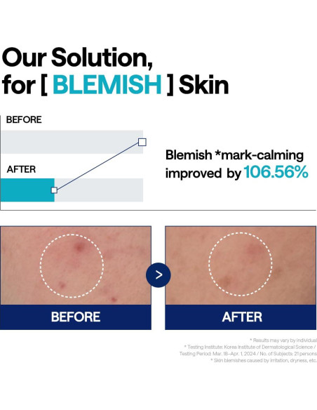 Suero Reparador Mediheal Madecassoside 40 ml - Cuidado Piel Suero Reparador Mediheal Madecassoside 40 ml - Cuidado Piel