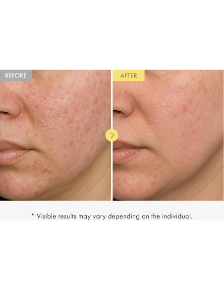 Suero Facial TOSOWOONG Honey Glow 65% 33ml - Hidratante y Brillante