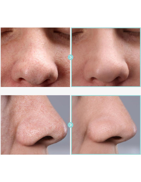 Suero Astringente de Poros TOSOWOONG 30ml - Niacinamida y Alantoína