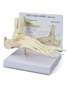 Modelo de Pie y Tobillo GPI Anatomicals con Fascitis Plantar