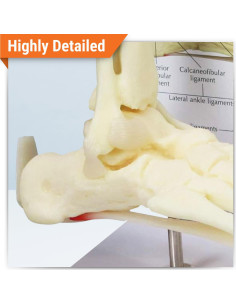 Modelo de Pie y Tobillo GPI Anatomicals con Fascitis Plantar 2