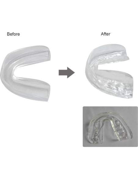 4 Protectores Bucales Moldeables Zooshine Chroma para Deportes