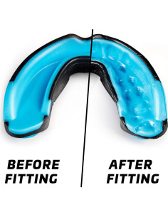 Guardia Bucal Profesional Legenda Octagon para Deportes 11+ 2