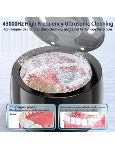 Limpiadora Ultrasónica UV Ackture para Dentaduras y Joyería 42kHz