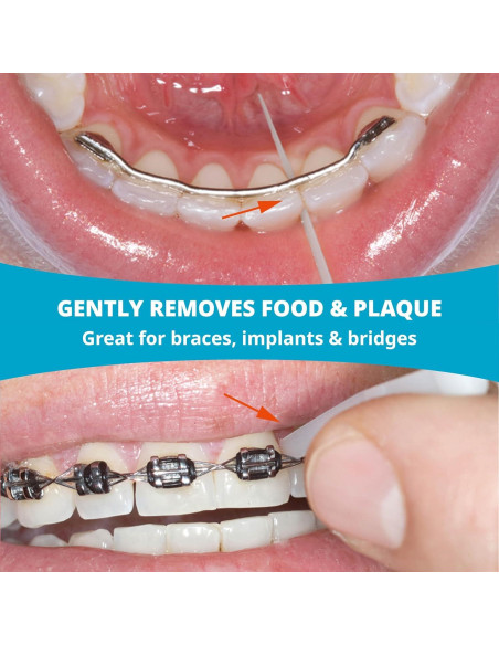 Palillos Dentales Opalpix 32 Unidades Cuidado Oral Suave Palillos Dentales Opalpix 32 Unidades Cuidado Oral Suave