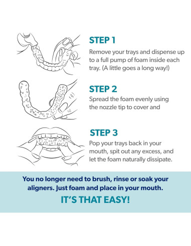 EverSmile AlignerFresh 50ml - Limpiador y Blanqueador Dental