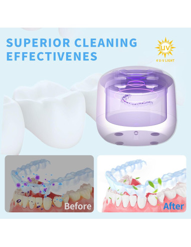 Limpiador Ultrasónico ZONIX 300ML para Retenedores y Joyería