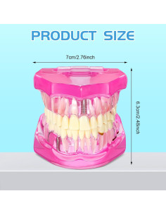 Modelo de Dientes Patológicos Rosa Outus para Educación Dental 2