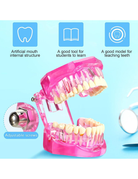 Modelo de Dientes Patológicos Rosa Outus para Educación Dental