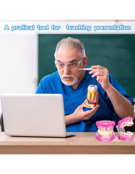 Modelo de Dientes Patológicos Rosa Outus para Educación Dental